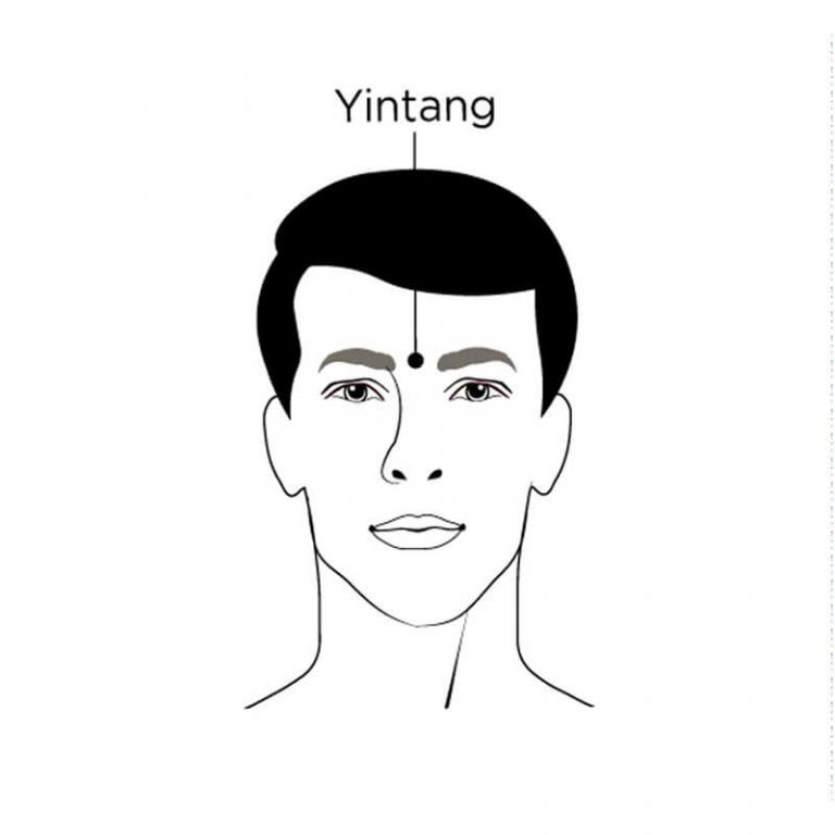 Yintang acupoint